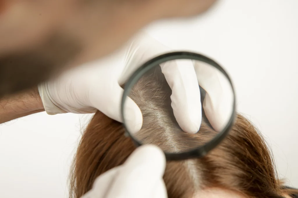 Scalp condition evaluation