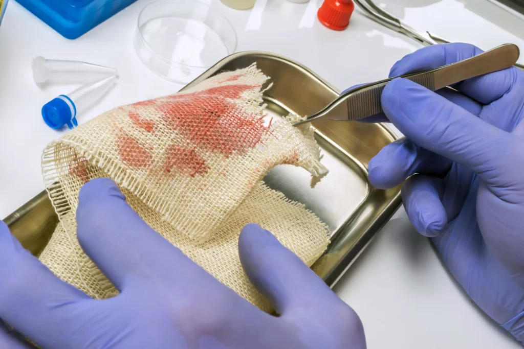 blood stains on cloth